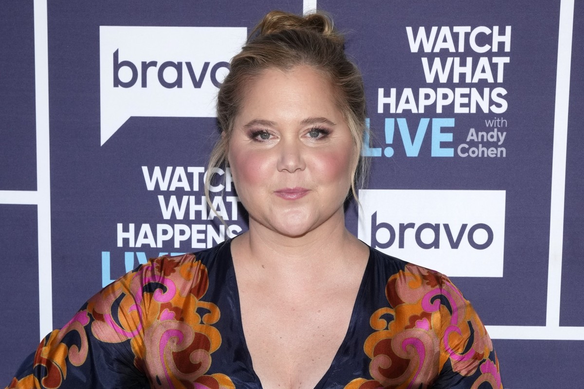 Amy Schumer Revela Que Padece El Síndrome De Cushing Vida Latina