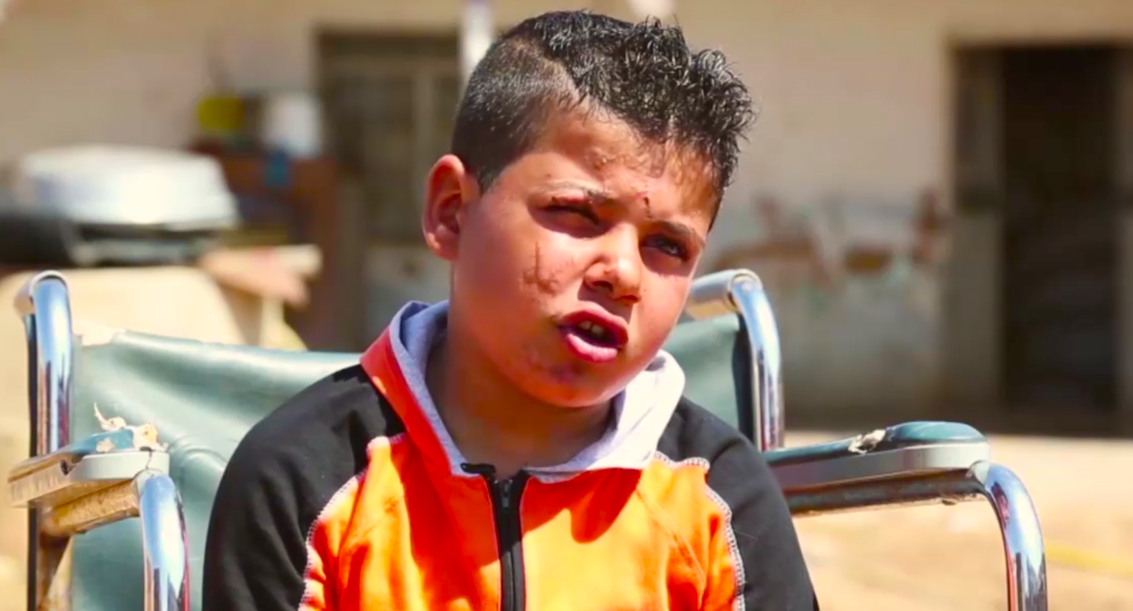 NOMASMINASS - Historia De Un Niño Tras La Explosión De Una Mina