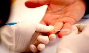 HEPATITIS 300x180 - Extrañas Advertencias Del Departamento De Salud Ruso