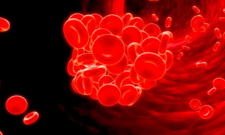 anemia 2 1000x600 450x270 - ¡Adiós Anemia Falciforme!