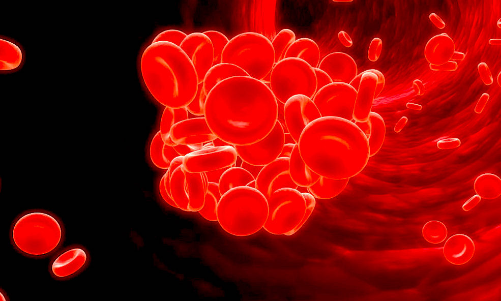 anemia 2 1000x600 - ¡Adiós Anemia Falciforme!