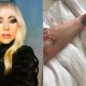 lady gaga 80x80 - Lady Gaga Hospitalizada, No Estará En Río