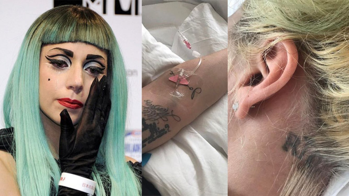 lady gaga fiibromialgia - Lady Gaga Suspende Gira Mundial