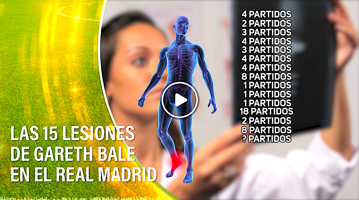 BALE - Las 15 Lesiones De Gareth Bale En El Real Madrid