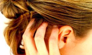 PSORIASIS 300x180 - La Psoriasis: Mitos y Realidades