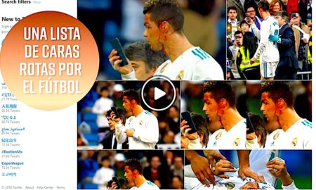 CRIS 450x270 - Cristiano No está Solo: Una Lista Con Caras Sangrantes