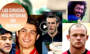 CIRUGIAS 300x180 - Las Caras Más Transformadas Del Fútbol y El Deporte