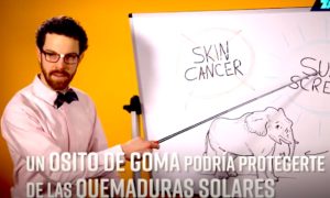 QUEMADURAS 300x180 - Gomitas Que Te Protegen De La Radiación Solar