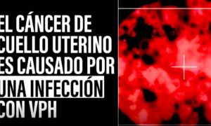 CANCER UTERINO 300x180 - Australia, ¿Primer País En Erradicar El Cáncer De Cuello Uterino?