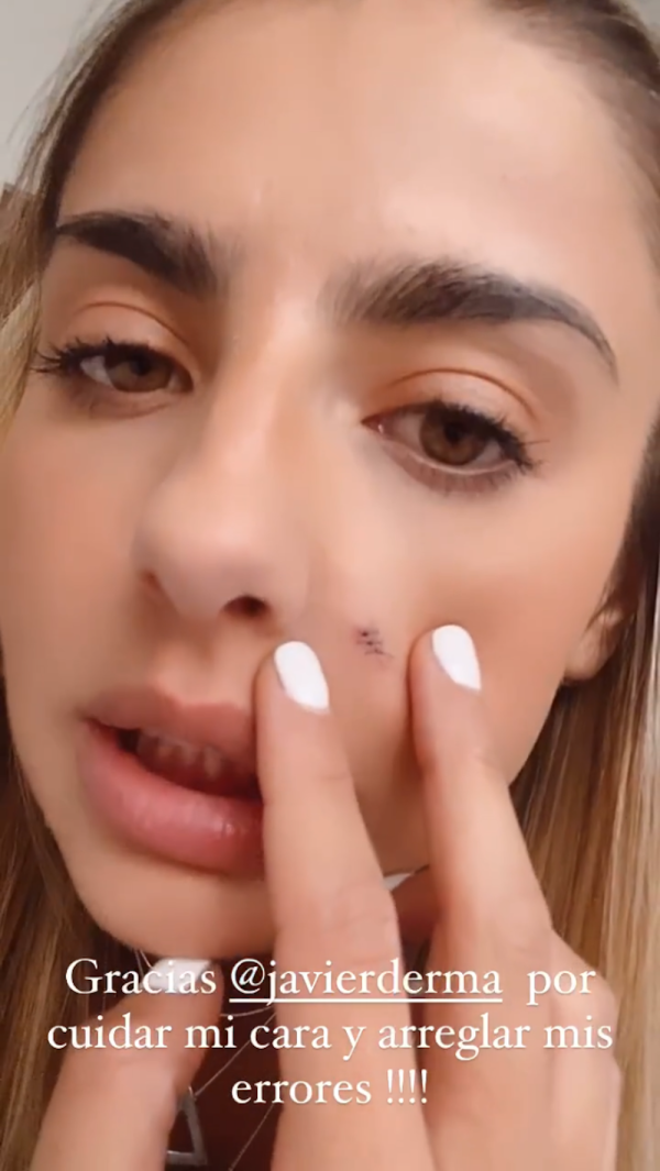 descarga 18 - Michelle Renaud explica por qué tiene una extraña marca en la cara
