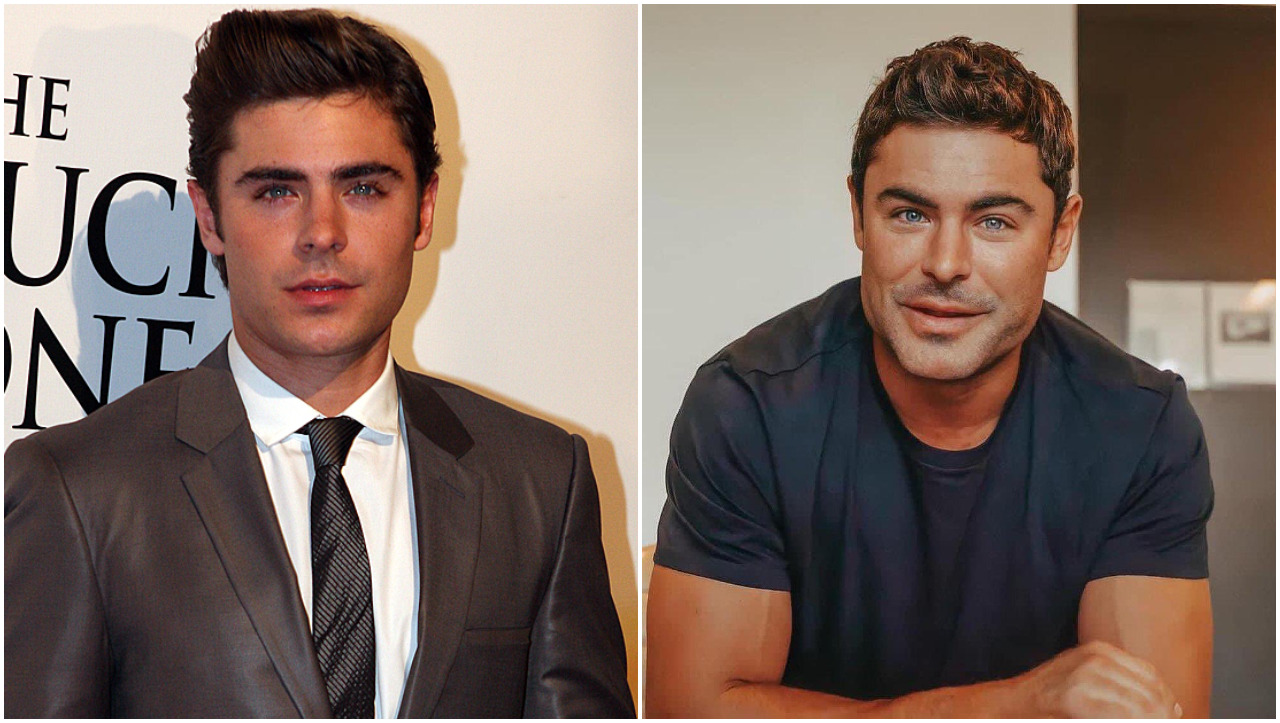 zacefron - La razón por la que todo el mundo habla de la cara de Zac Efron