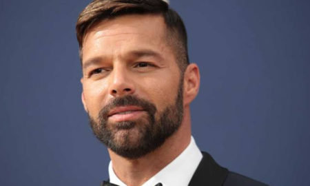 ricky martin 1 450x270 - Ricky Martin tuvo reacción alérgica en la cara