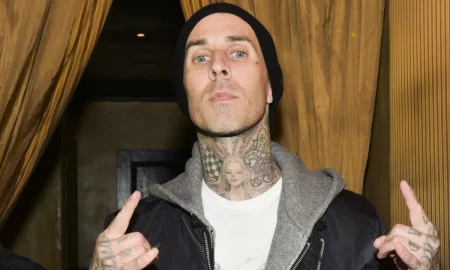 travisbarker2 getty 450x270 - Travis Barker publica una foto de su fractura