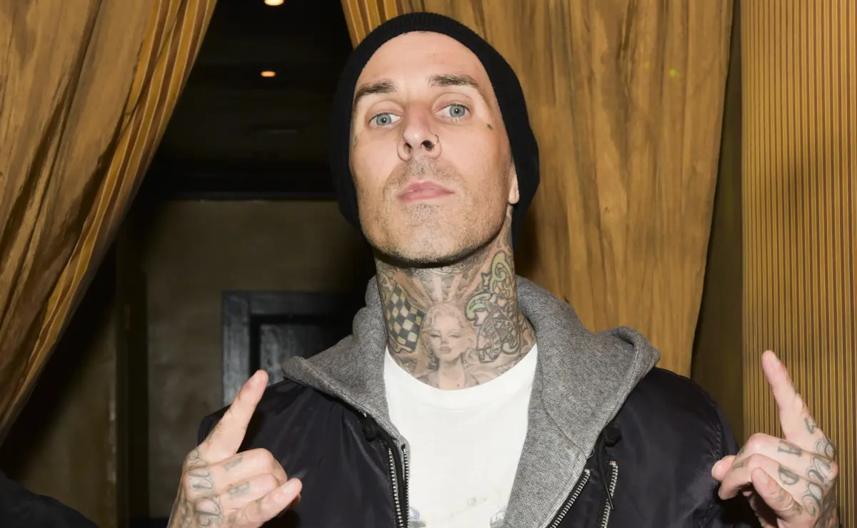 travisbarker2 getty - Travis Barker publica una foto de su fractura